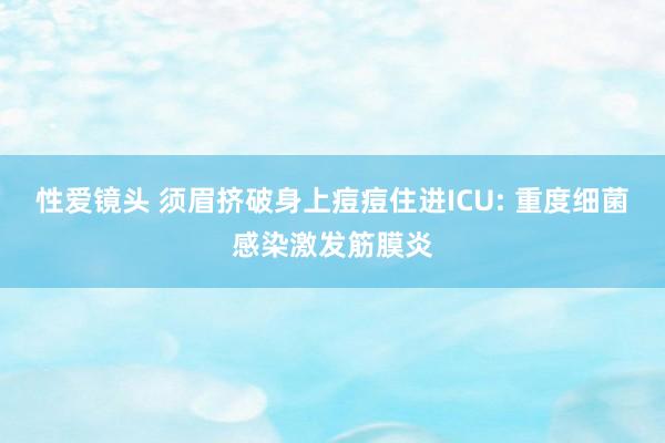 性爱镜头 须眉挤破身上痘痘住进ICU: 重度细菌感染激发筋膜炎