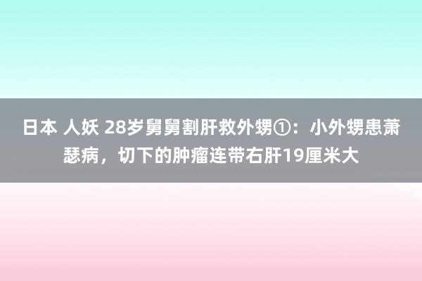 日本 人妖 28岁舅舅割肝救外甥①：小外甥患萧瑟病，切下的肿瘤连带右肝19厘米大